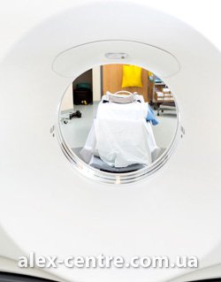 МРТ грудного позвоночника